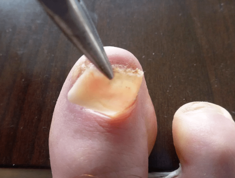 Distance de la plaque